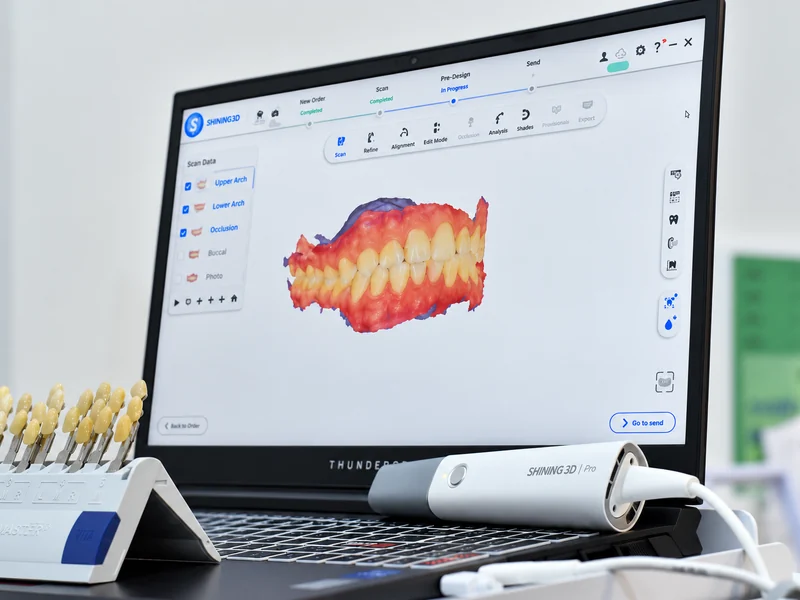 Shining3D intraoral scanner and a 3D scan of a patient's teeth