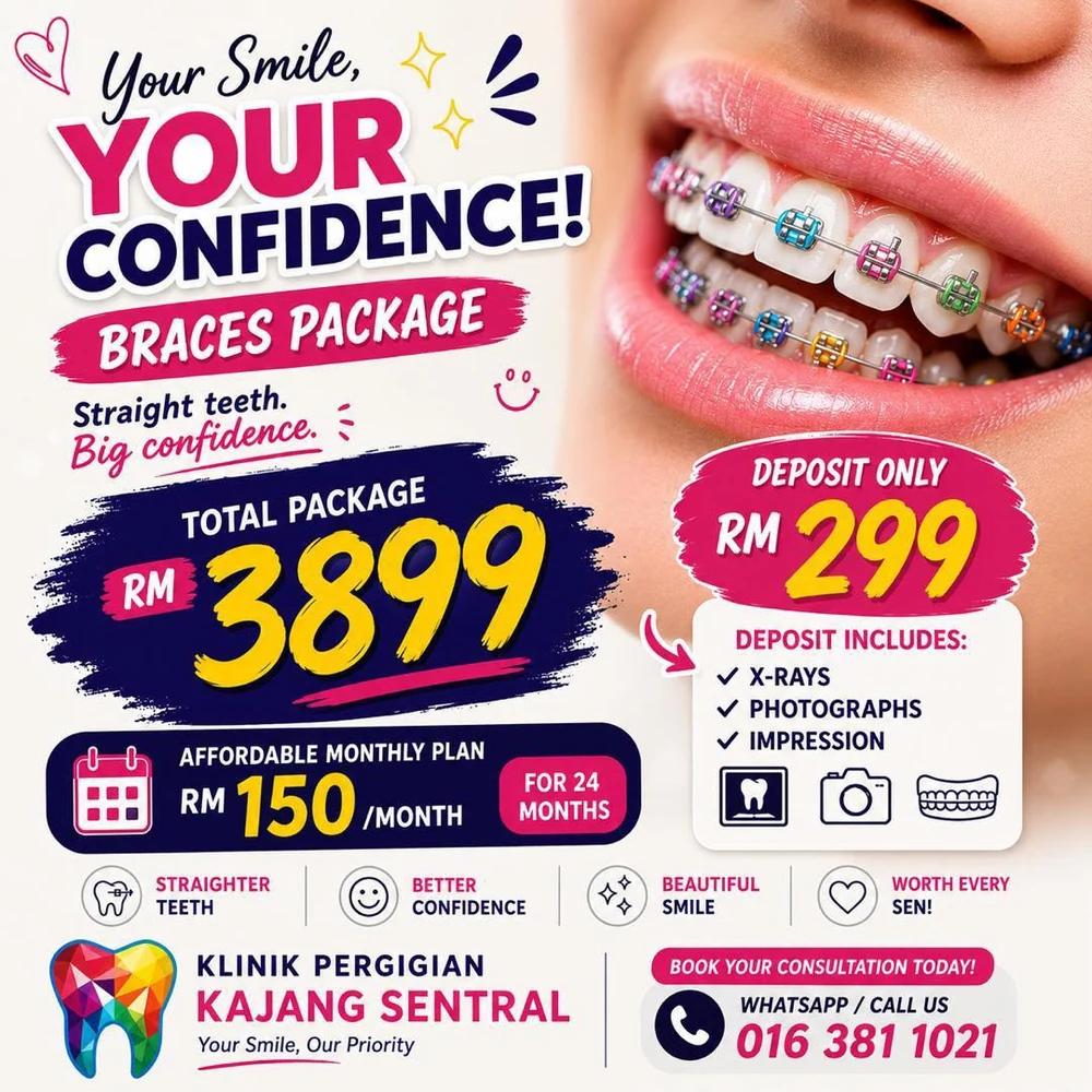 Braces package promotion: total RM3,899, deposit RM299, RM150 per month for 24 months
