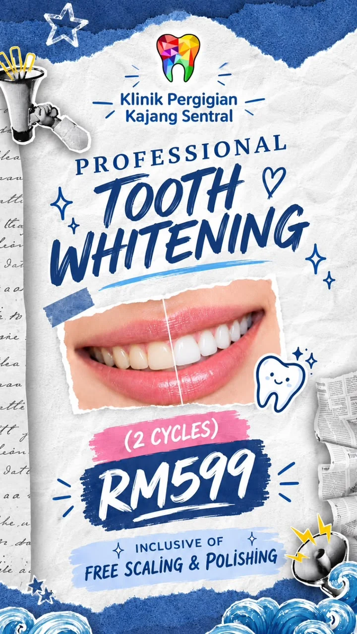 Professional tooth whitening promotion: 2 cycles for RM599 including free scaling and polishing